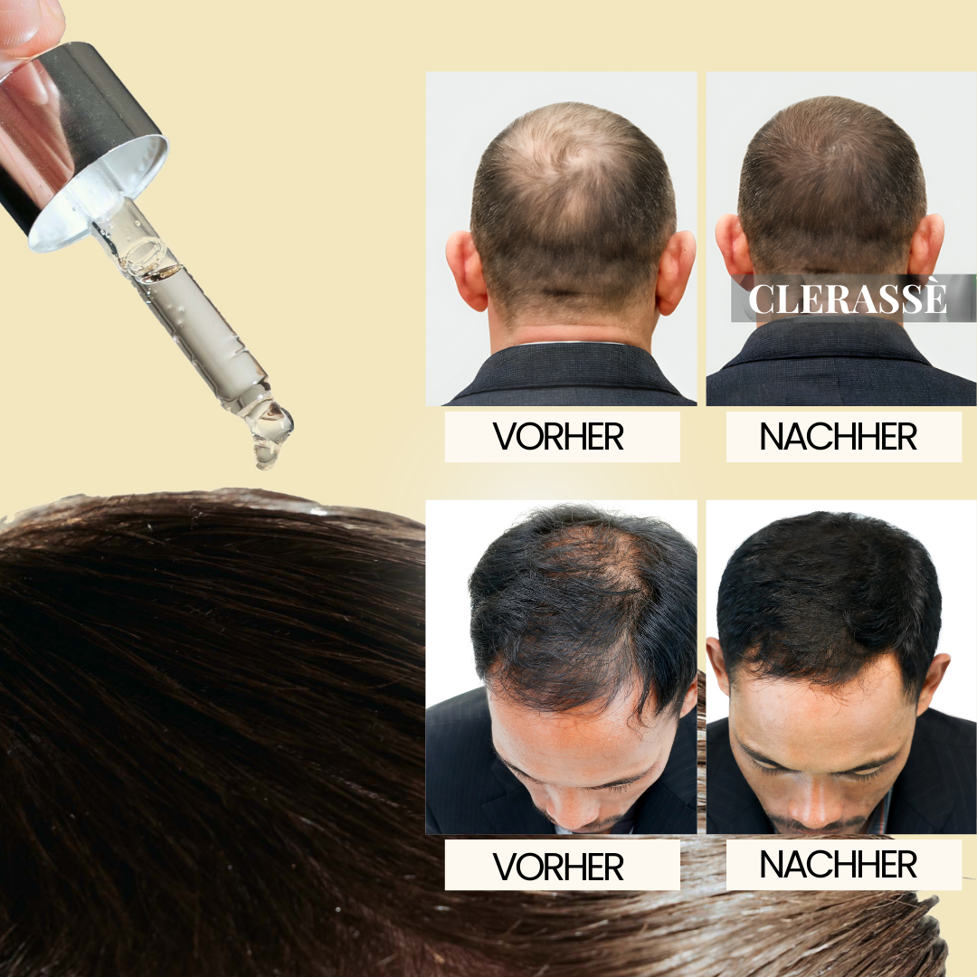 CLERASSÈ - HAAR SERUM FÜR MÄNNER